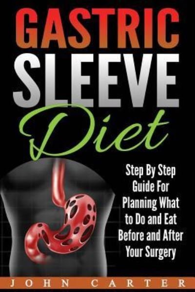 Gastric Sleeve Diet: Step By Step Guide For Planning What to Do and Eat Before and After Your Surgery - Gastric Sleeve - John Carter - Kirjat - Guy Saloniki - 9781951103583 - lauantai 13. heinäkuuta 2019