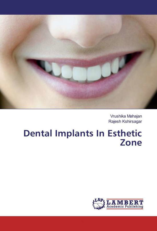 Cover for Mahajan · Dental Implants In Esthetic Zon (Book)