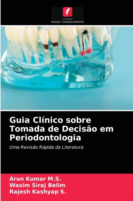 Cover for Arun Kumar M S · Guia Clinico sobre Tomada de Decisao em Periodontologia (Paperback Book) (2021)