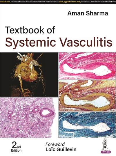 Cover for Aman Sharma · Textbook of Systemic Vasculitis (Gebundenes Buch) [2 Revised edition] (2023)