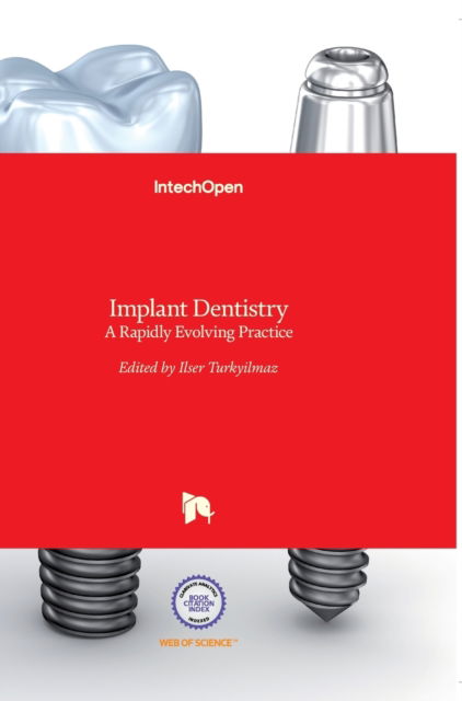 Cover for Ilser Turkyilmaz · Implant Dentistry: A Rapidly Evolving Practice (Hardcover Book) (2011)