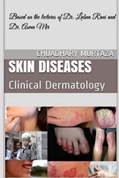 Cover for Murtaza Chuadhary Murtaza · Skin Diseases: Clinical Dermatology (Paperback Book) (2020)