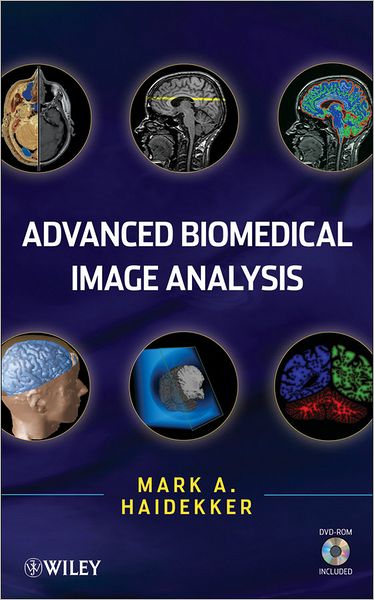 Cover for Mark Haidekker · Advanced Biomedical Image Analysis (Hardcover Book) (2010)