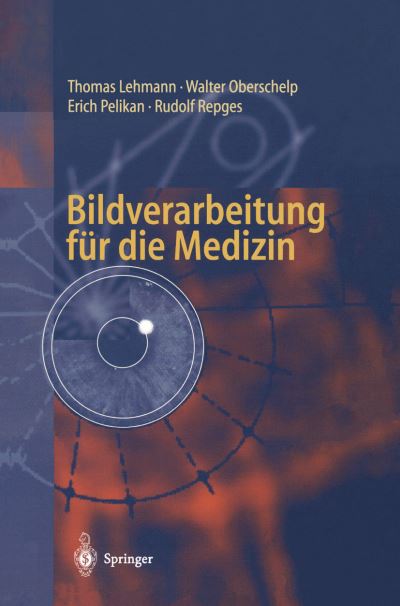 Bildverarbeitung Fur Die Medizin - Thomas Lehmann - Books - Springer-Verlag Berlin and Heidelberg Gm - 9783540614586 - October 28, 1997