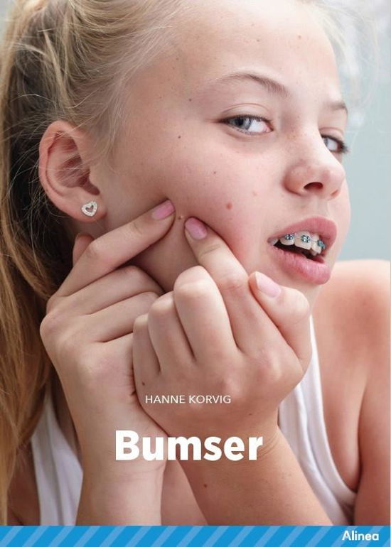 Cover for Hanne Korvig · Fagklub: Bumser, Blå Fagklub (Bound Book) [1e uitgave] (2022)