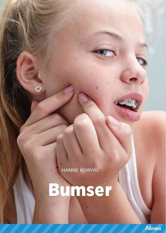 Cover for Hanne Korvig · Fagklub: Bumser, Blå Fagklub (Indbundet Bog) [1. udgave] (2022)