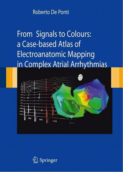 From Signals to Colours: A Case-based Atlas of Electroanatomic Mapping in Complex Atrial arrhythmias - Roberto De Ponti - Książki - Springer Verlag - 9788847015586 - 21 października 2010