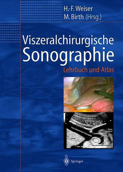 Viszeralchirurgische Sonographie: Lehrbuch Und Atlas - H -f Weiser - Bücher - Springer-Verlag Berlin and Heidelberg Gm - 9783642629587 - 1. September 2014