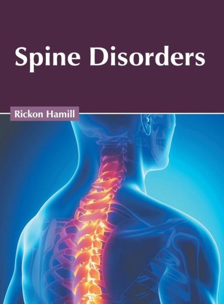 Cover for Rickon Hamill · Spine Disorders (Hardcover Book) (2019)