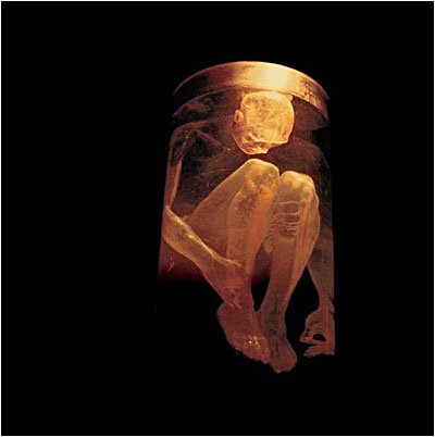 Cover for Alice in Chains · Music Bank the Videos +cd (DVD) (2006)