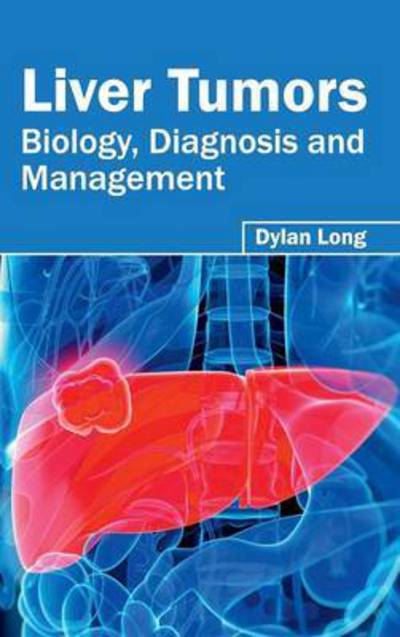 Cover for Dylan Long · Liver Tumors: Biology, Diagnosis and Management (Inbunden Bok) (2015)