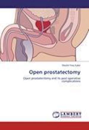 Cover for Kabir · Open prostatectomy (Book)