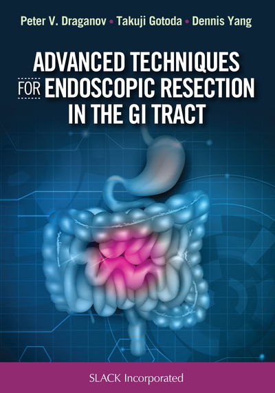 Cover for Peter Draganov · Advanced Techniques for Endoscopic Resection in the GI Tract (Hardcover Book) (2019)