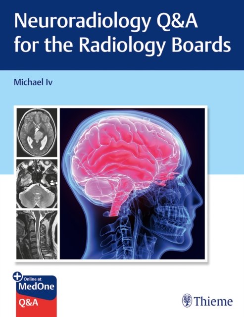 Cover for Michael Iv · Neuroradiology Q&amp;A for the Radiology Boards (Paperback Book) (2022)