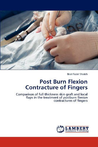 Cover for Bilal Fazal Shaikh · Post Burn Flexion Contracture of Fingers: Comparison of Full Thickness Skin Graft and Local Flaps in the Treatment of Postburn Flexion Contractures of Fingers (Paperback Book) (2012)
