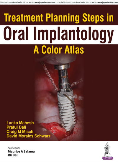 Cover for Lanka Mahesh · Treatment Planning Steps in Oral Implantology: A Color Atlas (Pocketbok) (2017)