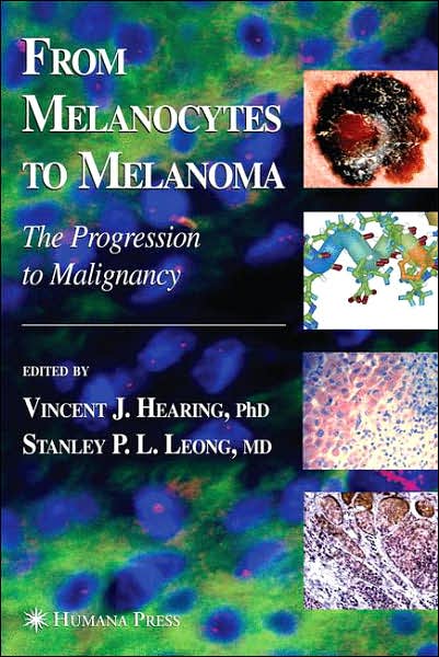 Cover for From Melanocytes to Melanoma: the Progression to Malignancy (Hardcover Book) (2005)