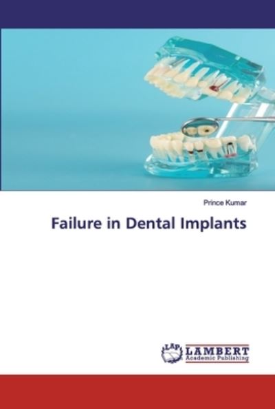 Cover for Kumar · Failure in Dental Implants (Bok) (2020)