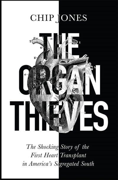 Cover for Chip Jones · The Organ Thieves (Paperback Book) (2020)