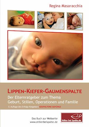 Cover for Regina Masaracchia · Lippen-Kiefer-Gaumenspalte (Paperback Book) (2021)
