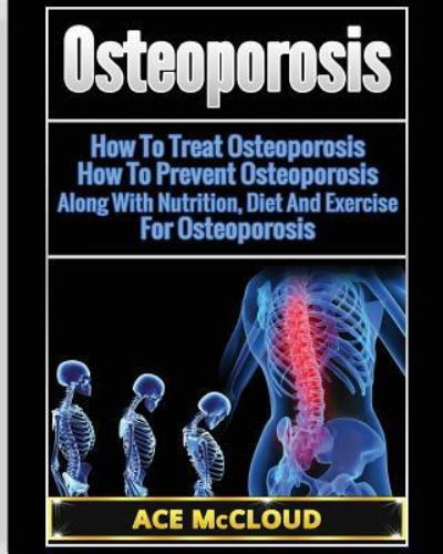 Cover for Ace McCloud · Osteoporosis (Paperback Book) (2017)