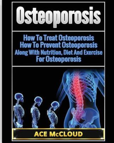 Osteoporosis - Ace McCloud - Książki - Pro Mastery Publishing - 9781640480599 - 19 marca 2017