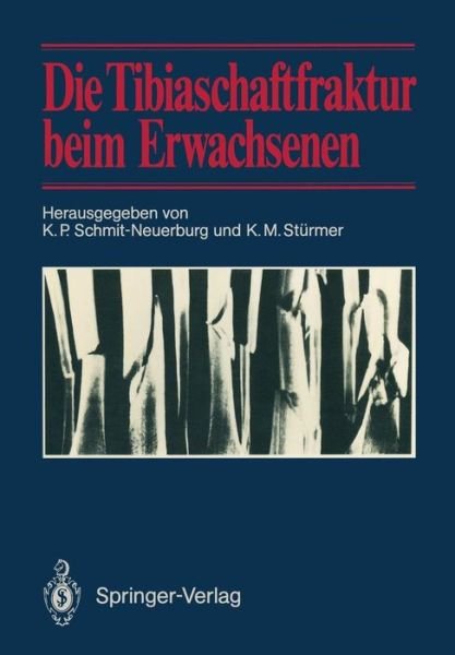 Cover for K P Schmit-neuerburg · Die Tibiaschaftfraktur Beim Erwachsenen (Paperback Book) [Softcover reprint of the original 1st ed. 1987 edition] (2011)