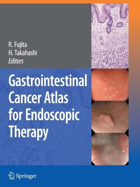 Cover for Rikiya Fujita · Gastrointestinal Cancer Atlas for Endoscopic Therapy (Taschenbuch) [Softcover reprint of hardcover 1st ed. 2009 edition] (2010)