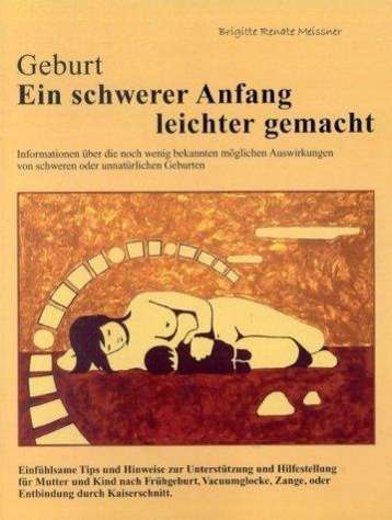 Cover for Meissner · Geburt, Ein schwerer Anfang le (Book)