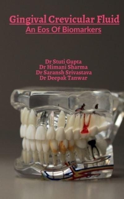 Cover for Stuti Gupta · Gingival Crevicular Fluid (Book) (2020)