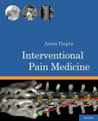 Interventional Pain Medicine - Anita Gupta - Książki - Oxford University Press Inc - 9780199740604 - 26 kwietnia 2012