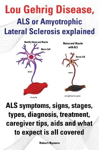 Cover for Robert Rymore · Lou Gehrig Disease, Als or Amyotrophic Lateral Sclerosis Explained. Als Symptoms, Signs, Stages, Types, Diagnosis, Treatment, Caregiver Tips, Aids and (Pocketbok) (2013)