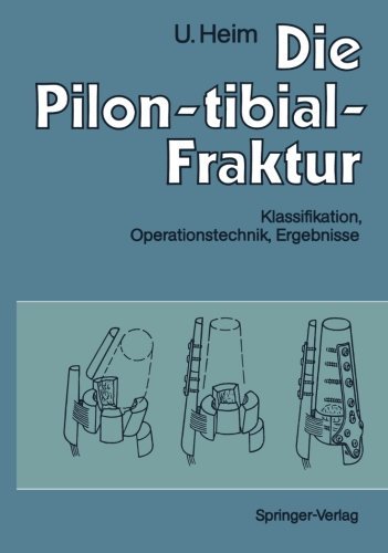 Cover for Urs Heim · Die Pilon-tibial-Fraktur (Pocketbok) [Softcover reprint of the original 1st ed. 1991 edition] (2012)