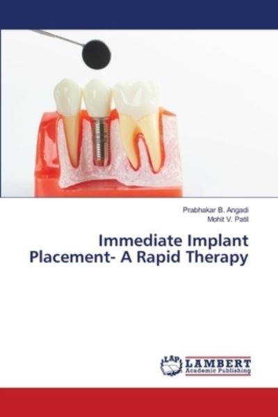 Cover for Prabhakar B Angadi · Immediate Implant Placement- A Rapid Therapy (Paperback Book) (2021)
