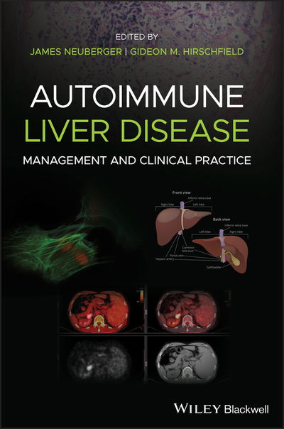 Cover for J Neuberger · Autoimmune Liver Disease: Management and Clinical Practice (Hardcover Book) (2020)