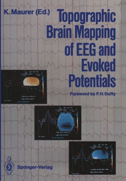 Cover for Konrad Maurer · Topographic Brain Mapping of EEG and Evoked Potentials (Paperback Book) [Softcover reprint of the original 1st ed. 1989 edition] (2011)