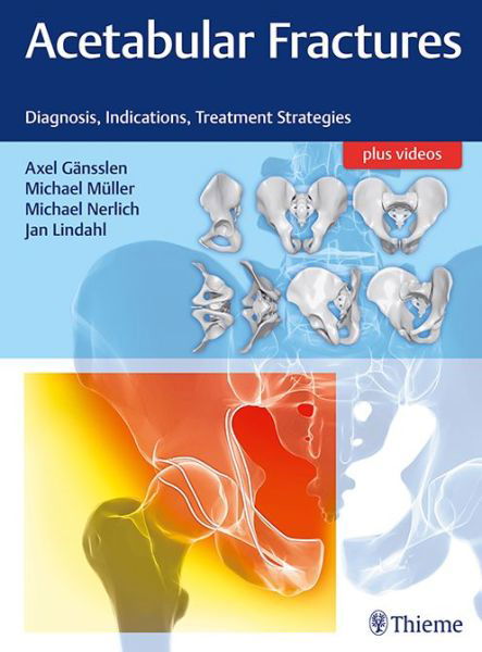 Acetabular Fractures: Diagnosis, Indications, Treatment Strategies - Heather T. Herdman - Livros - Thieme Publishing Group - 9783132415607 - 13 de dezembro de 2017