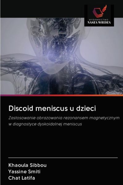 Cover for Khaoula Sibbou · Discoid meniscus u dzieci (Pocketbok) (2020)