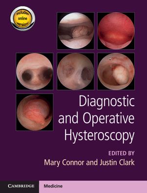 Cover for Mary Connor · Diagnostic and Operative Hysteroscopy (Hardcover bog) (2020)