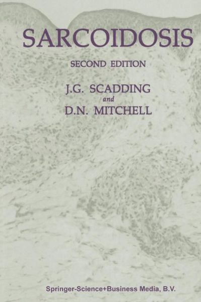 Sarcoidosis - J. G. Scadding - Books - Chapman and Hall - 9780412217609 - 1985