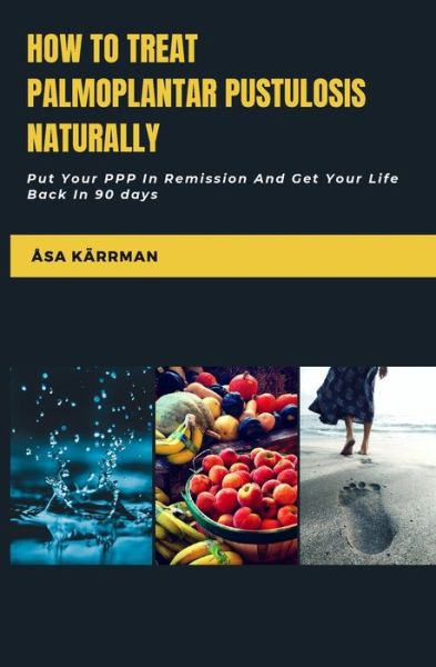 Cover for Asa Karrman · How To Treat Palmoplantar Pustulosis Naturally (Paperback Book) (2020)