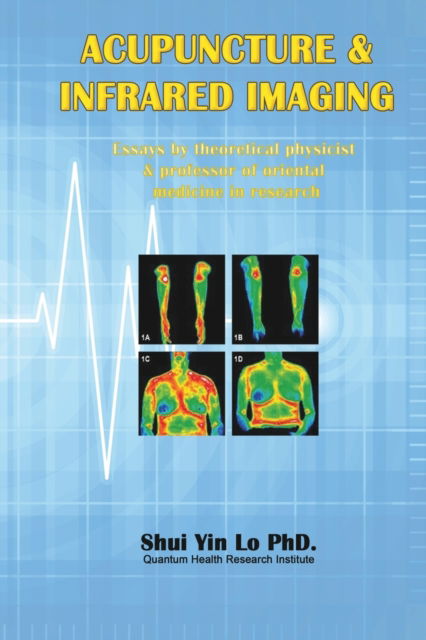 Cover for Shui Yin Lo · Acupuncture and Infrared Imaging: Essays by theoretical physicist &amp; professor of oriental medicine in research (Paperback Book) (2018)