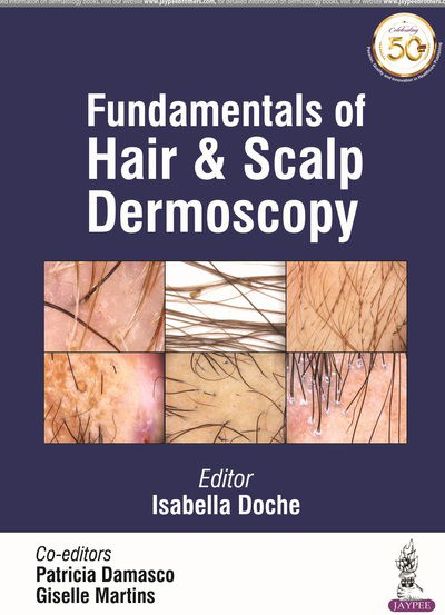 Cover for Isabella Doche · Fundamentals of Hair and Scalp Dermoscopy (Taschenbuch) (2019)