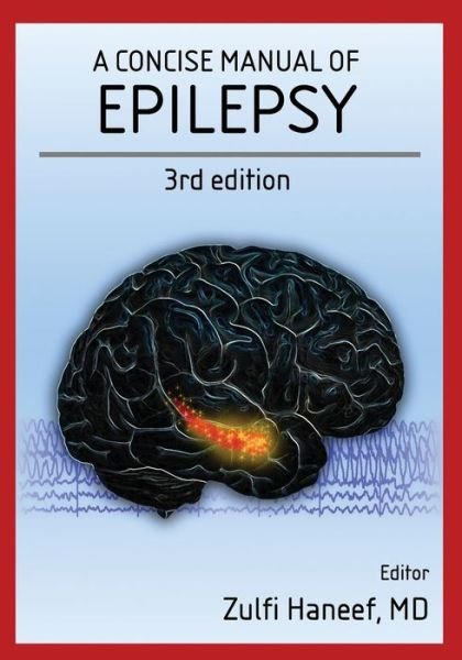 Cover for Zulfi Haneef · A concise manual of epilepsy (Paperback Book) (2016)