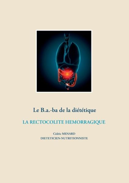 Cover for Cedric Menard · Le B.a.-ba de la dietetique de la rectocolite hemorragique (Taschenbuch) (2020)