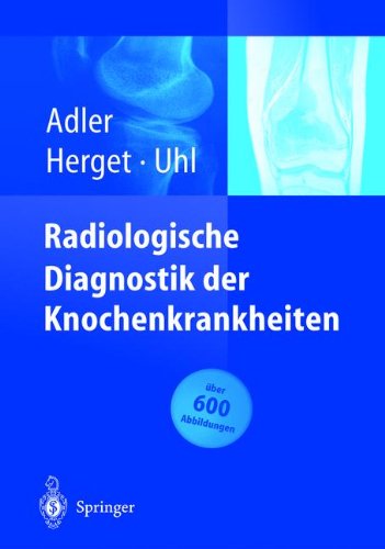 Cover for Adler, Claus-Peter, MD (Institute of Pathology, University of Freiburg, Freiburg, Germany) · Radiologische Diagnostik Der Knochenkrankheiten (Paperback Book) [Softcover Reprint of the Original 1st 2004 edition] (2014)