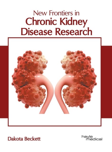 Cover for Dakota Beckett · New Frontiers in Chronic Kidney Disease Research (Hardcover bog) (2019)