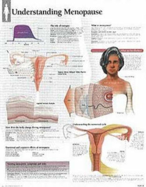 Understanding Menopause Laminated Poster - Scientific Publishing - Fanituote - Scientific Publishing Limited - 9781930633612 - perjantai 1. elokuuta 2003