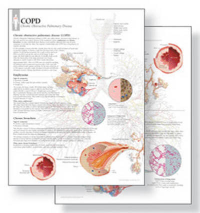 Cover for Scientific Publishing · Understanding COPD Study Set Replacement Pads: Patient Education Study Sets (Paperback Book) (2015)