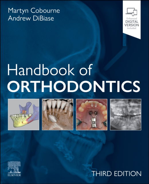 Cobourne, Martyn T. (Professor of Orthodontics, Department of Orthodontics and Craniofacial Development, King's College London Dental Institute; Hon Consultant in Orthodontics, Guy's and St Thomas' NHS Foundation Trust, King's Health Partners, UK) · Handbook of Orthodontics (Paperback Book) (2024)